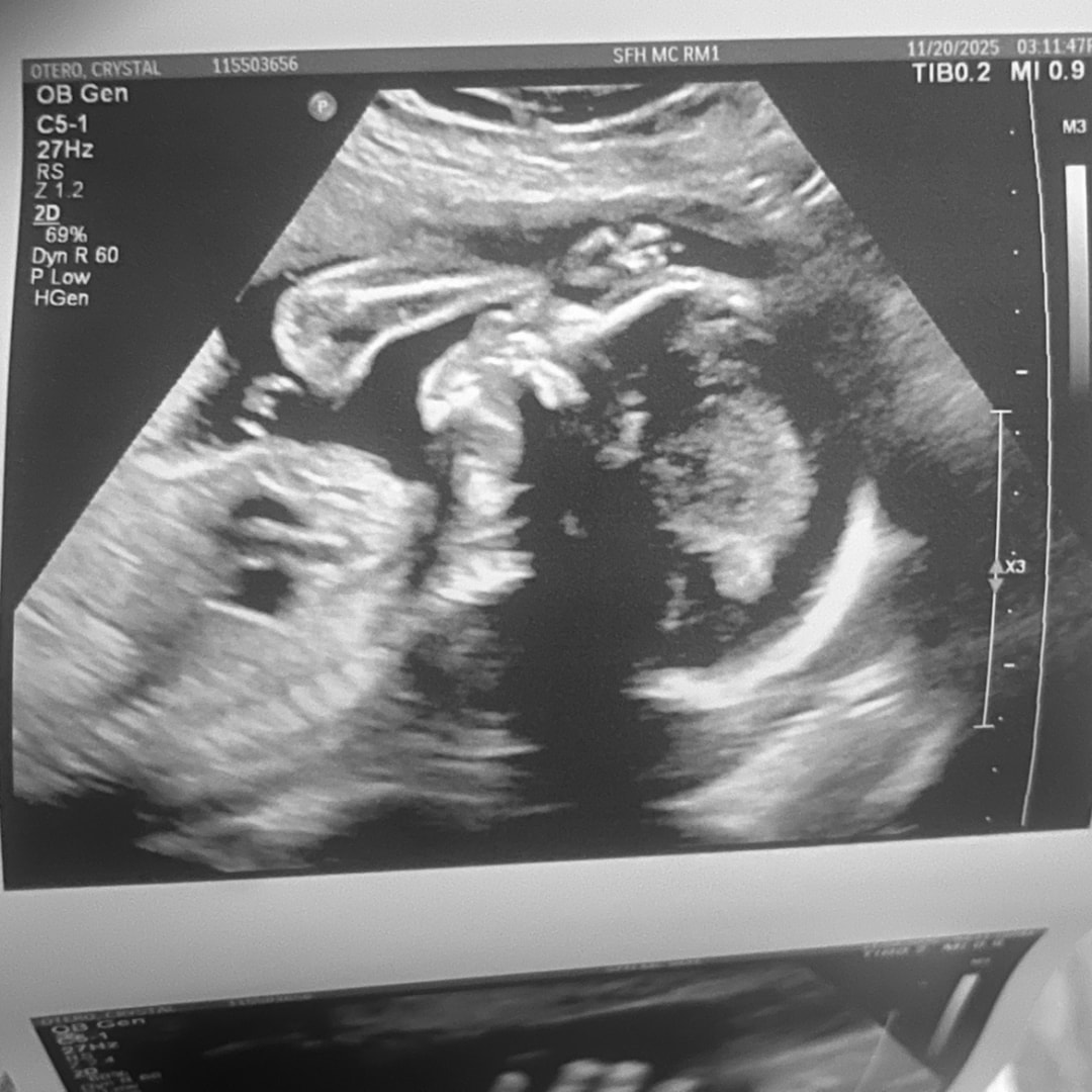 Photo shared by Crystal for their Babylist baby registry.