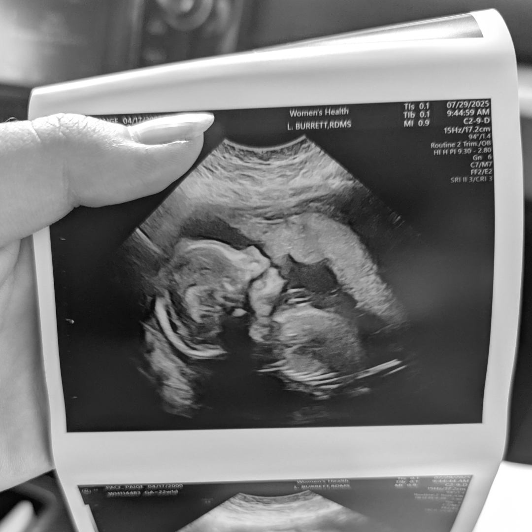 Photo shared by Paige for their Babylist baby registry.