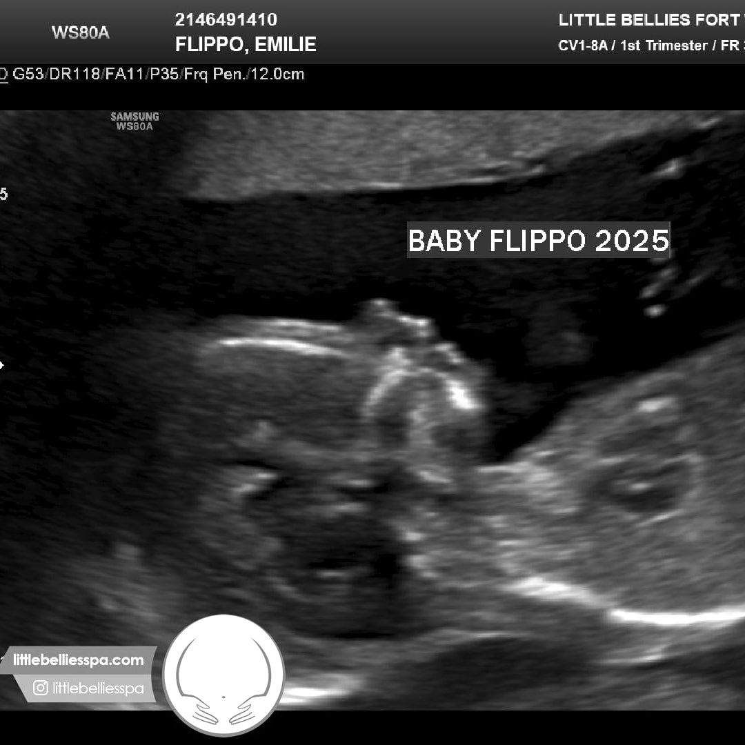 Photo shared by Emilie for their Babylist baby registry.