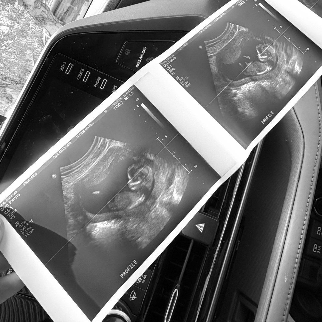 Photo shared by Alicia for their Babylist baby registry.