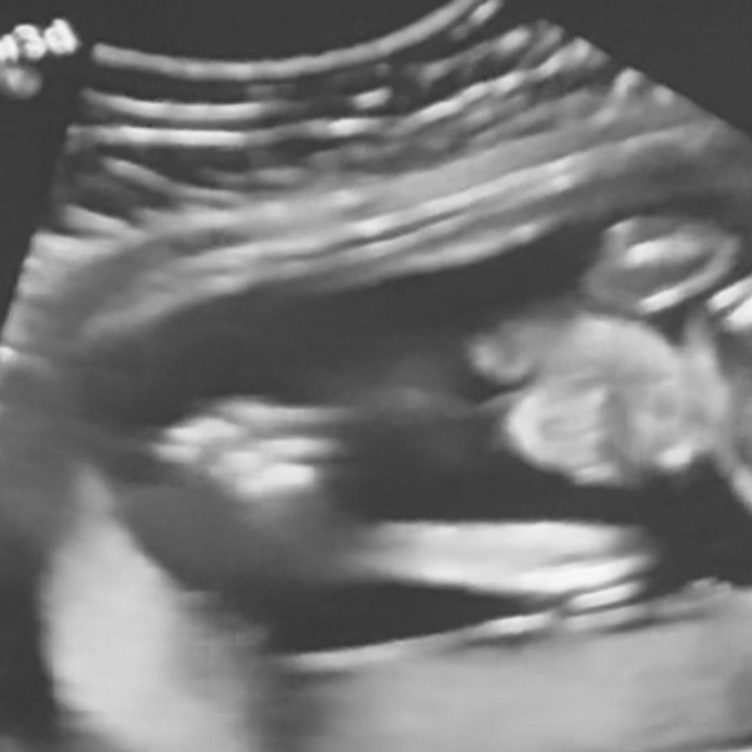 Photo shared by Alora for their Babylist baby registry.