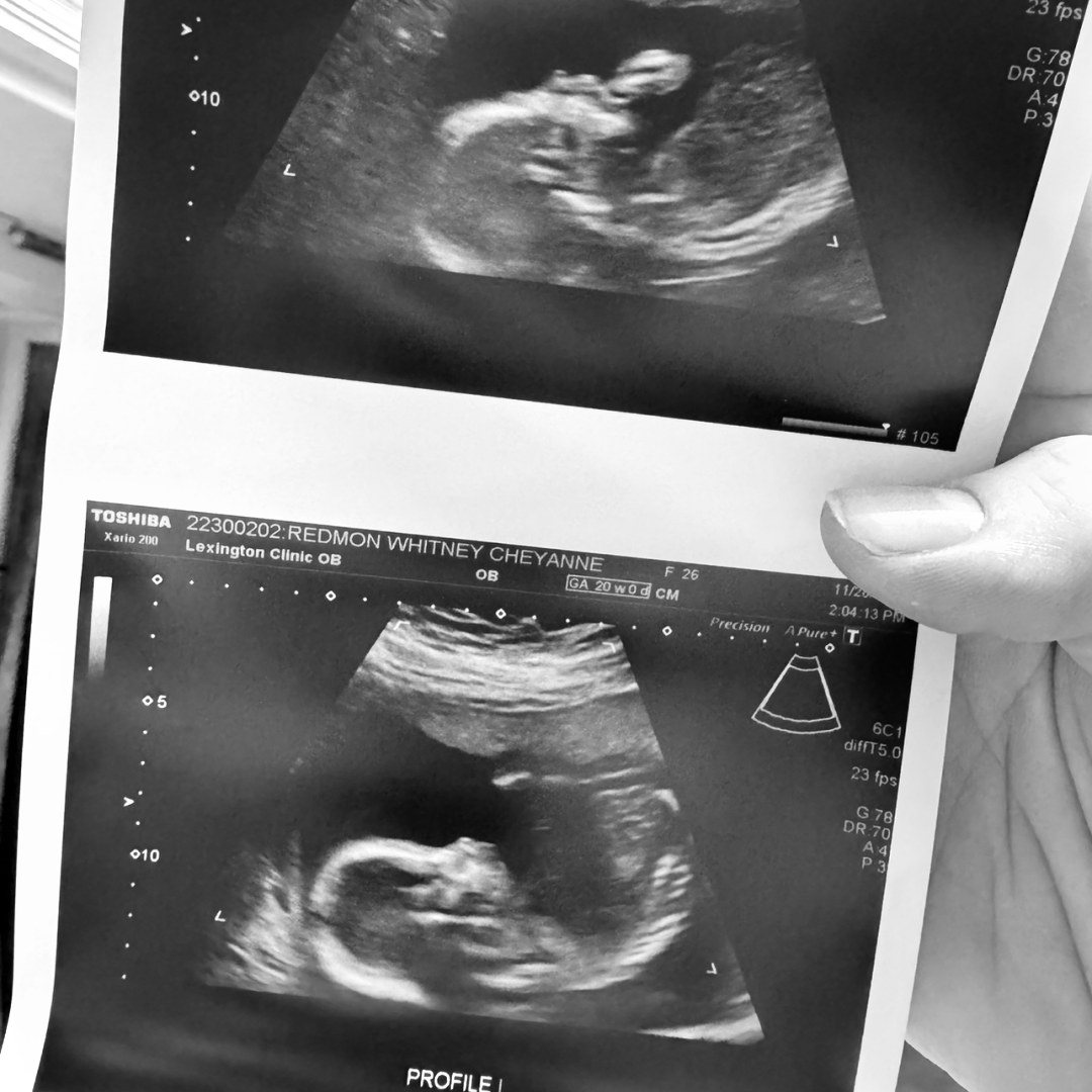 Photo shared by Whitney for their Babylist baby registry.