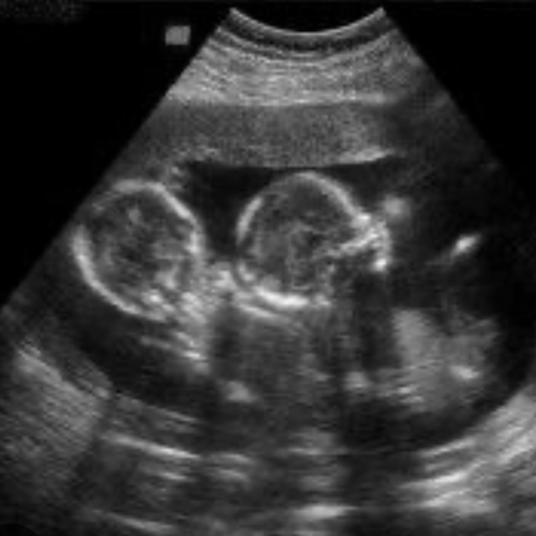 Photo shared by Anthony for their Babylist baby registry.