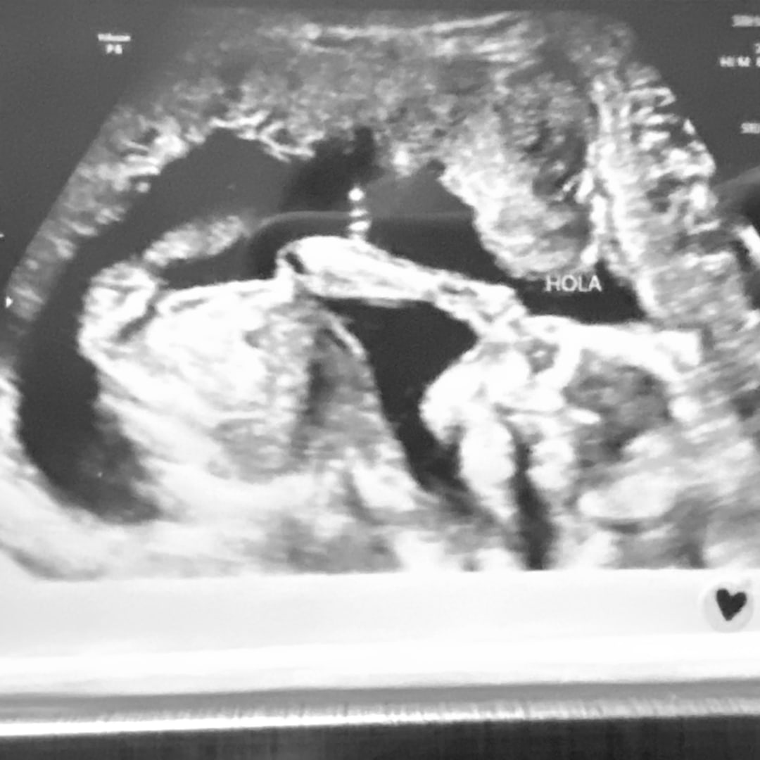 Photo shared by Tima & Jay for their Babylist baby registry.
