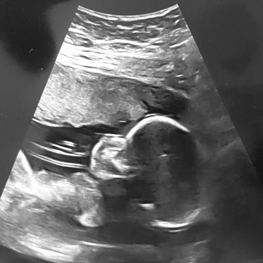 Photo shared by Jasmine for their Babylist baby registry.