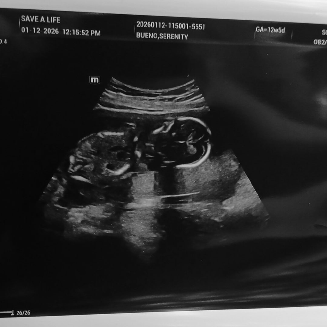 Photo shared by Serenity for their Babylist baby registry.