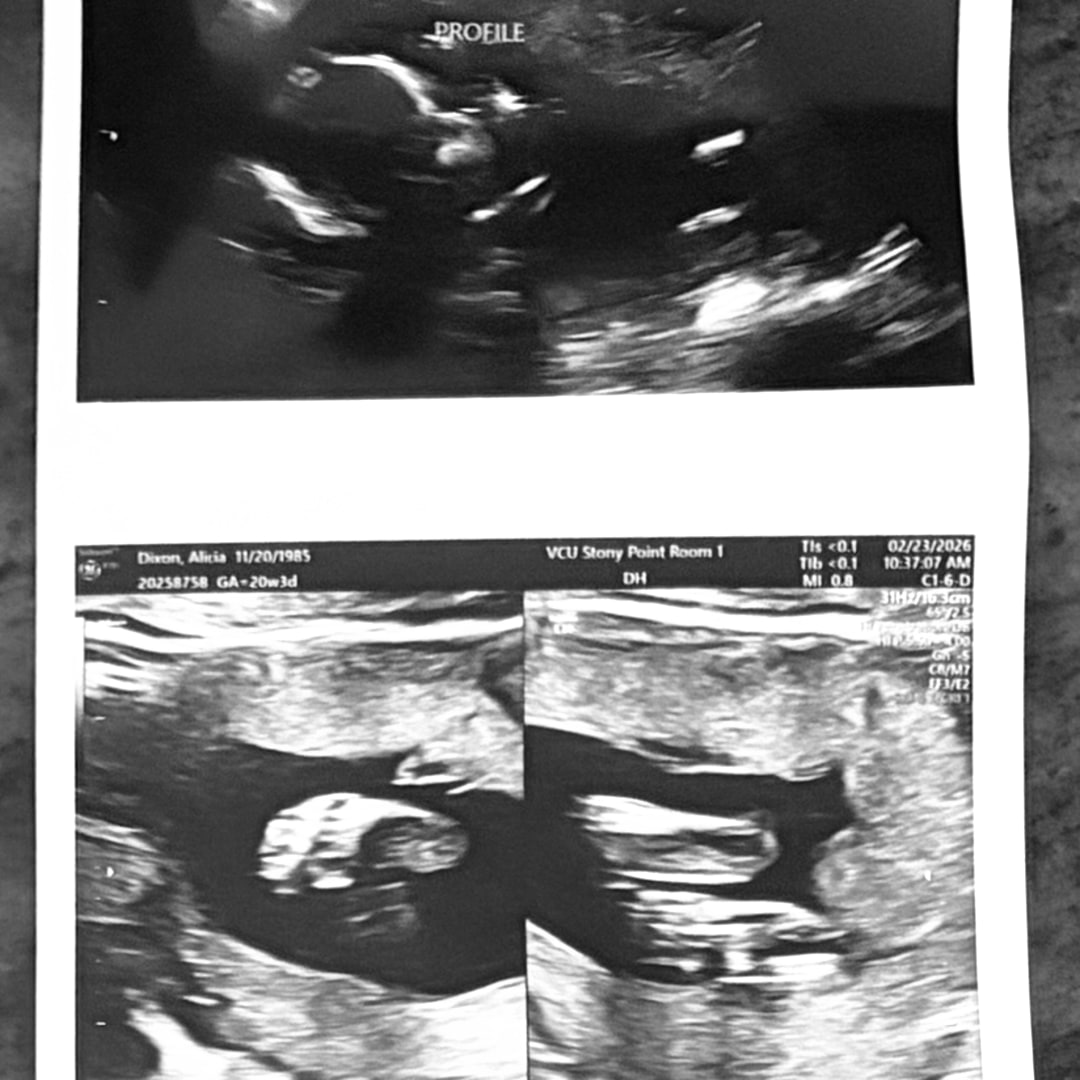Photo shared by Alicia for their Babylist baby registry.