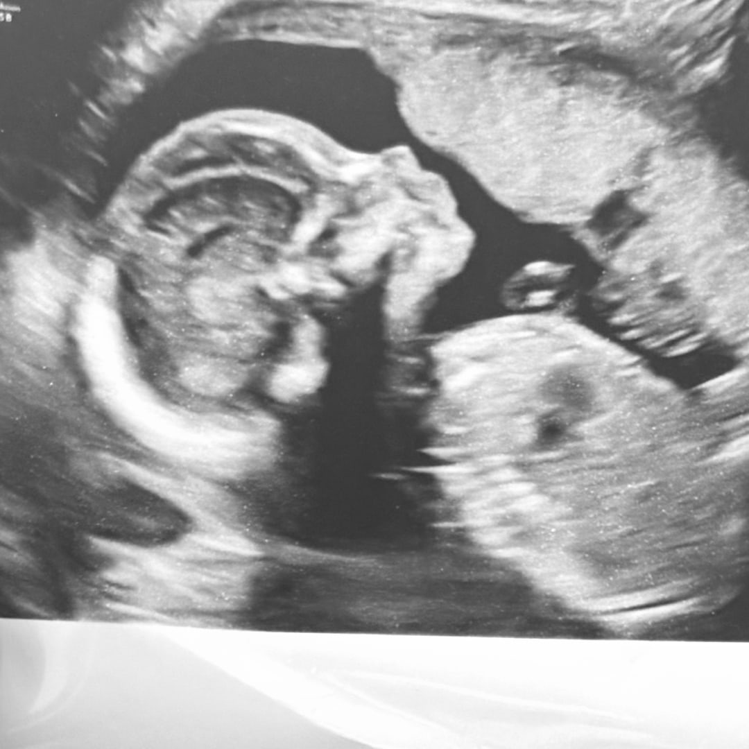 Photo shared by Kaden for their Babylist baby registry.