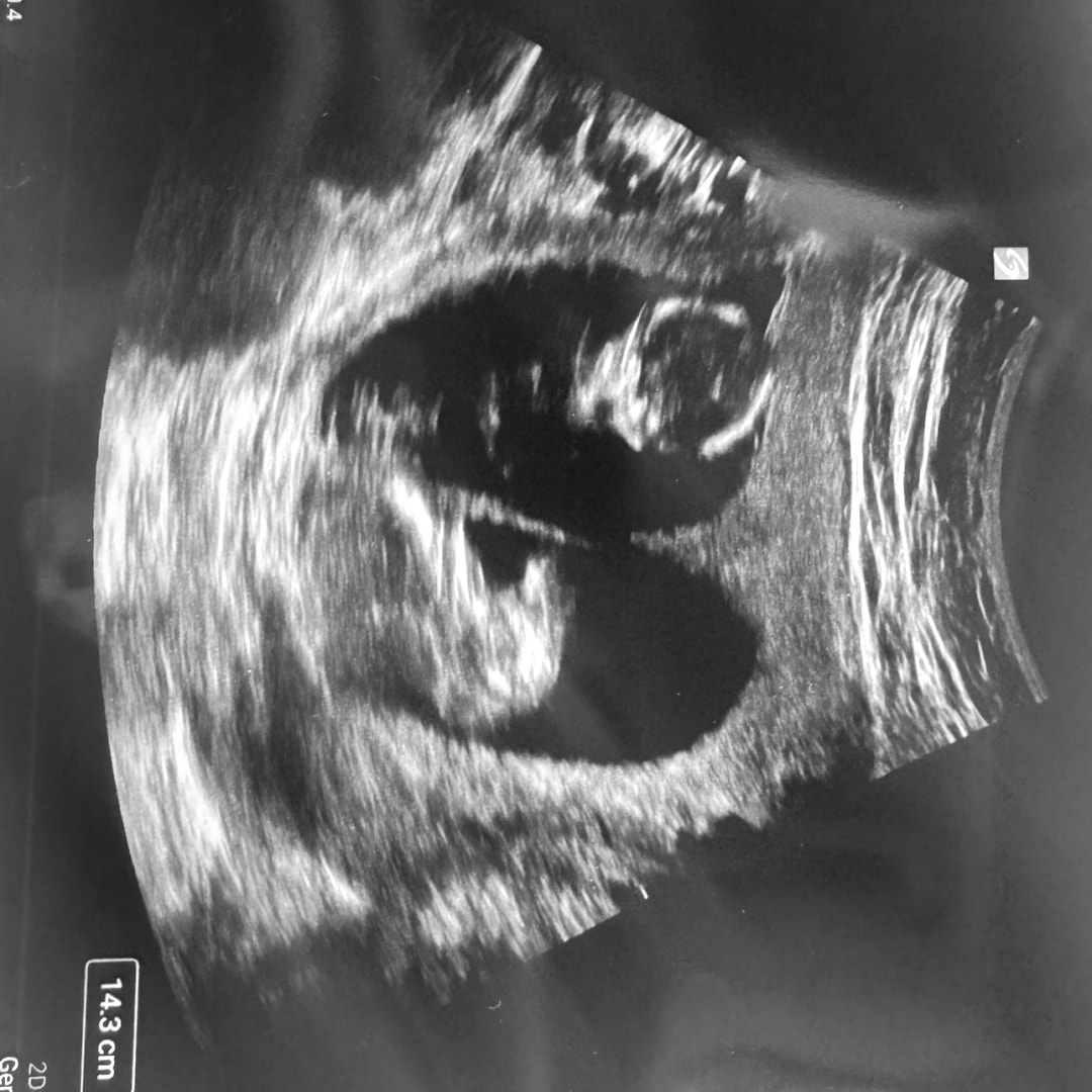 Photo shared by Alli for their Babylist baby registry.