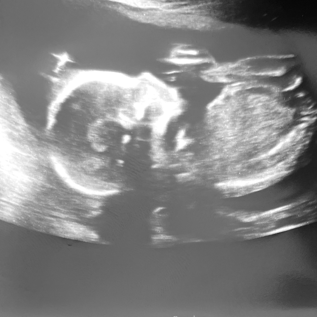 Photo shared by Victoria for their Babylist baby registry.
