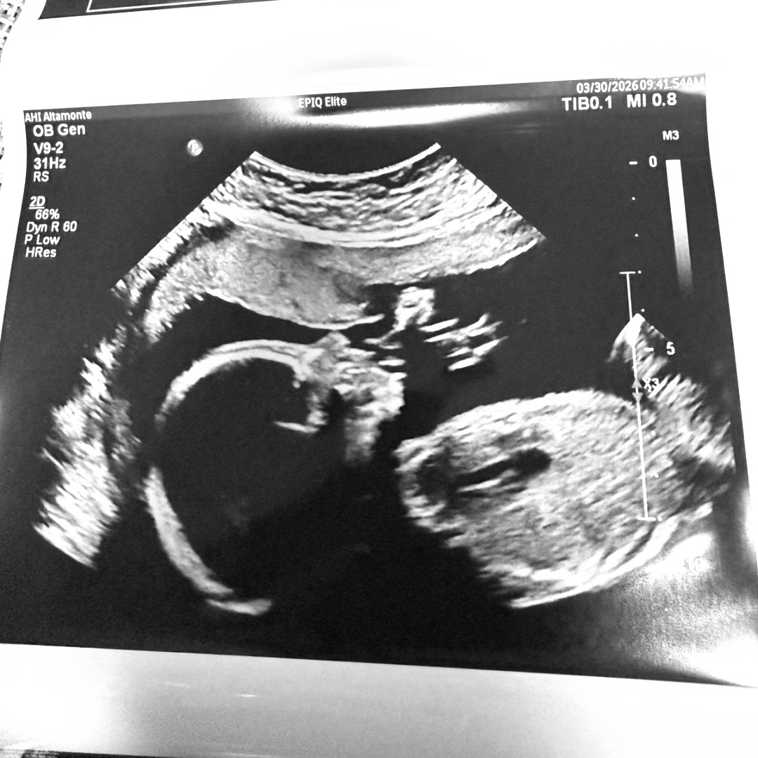 Photo shared by Alison for their Babylist baby registry.