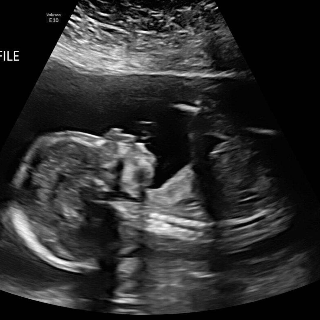 Photo shared by Kaitlyn for their Babylist baby registry.