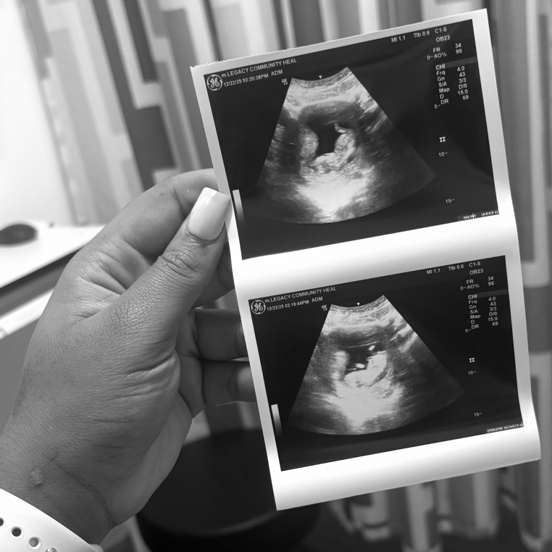 Photo shared by Iriel for their Babylist baby registry.