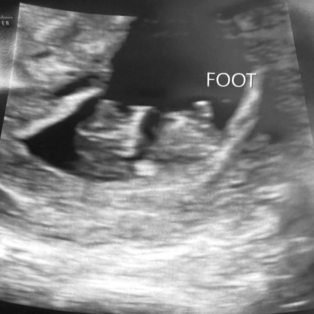 Photo shared by Lexi for their Babylist baby registry.