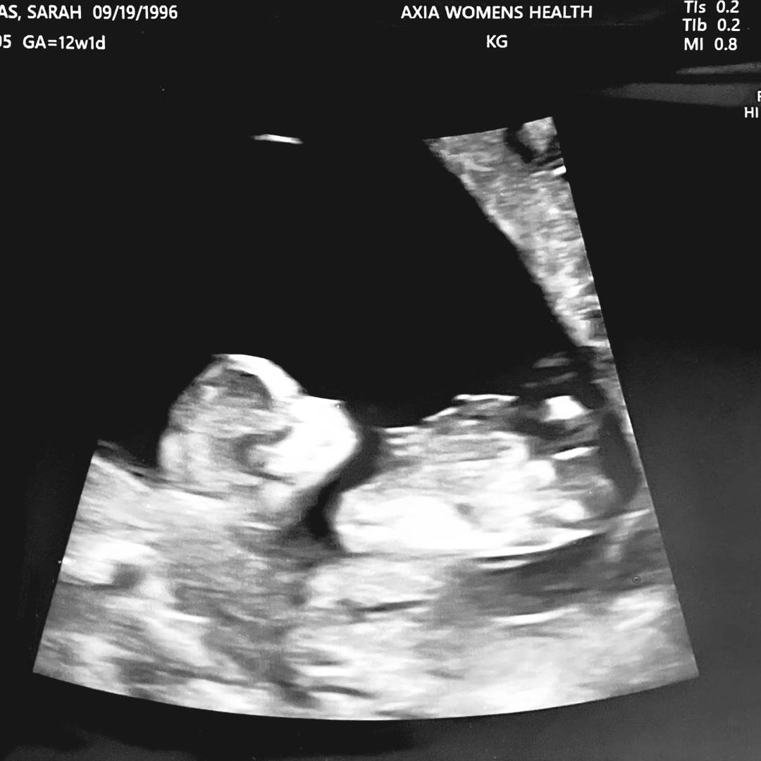 Photo shared by Sarah for their Babylist baby registry.