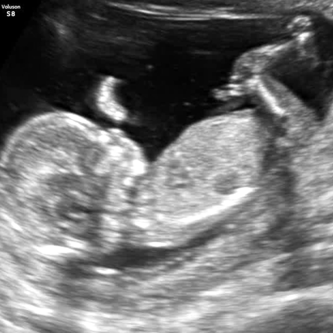 Photo shared by Tori for their Babylist baby registry.