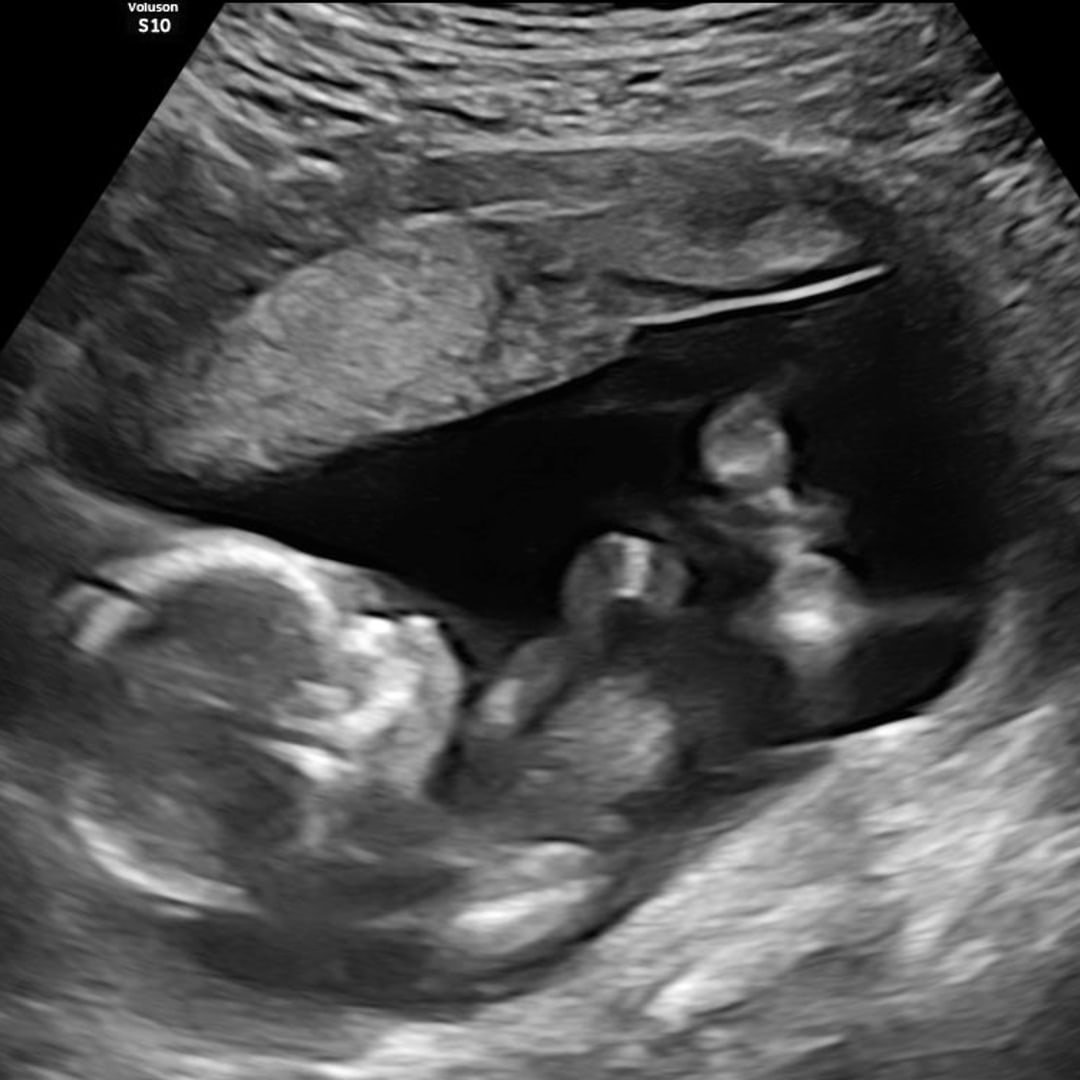 Photo shared by Ashley for their Babylist baby registry.