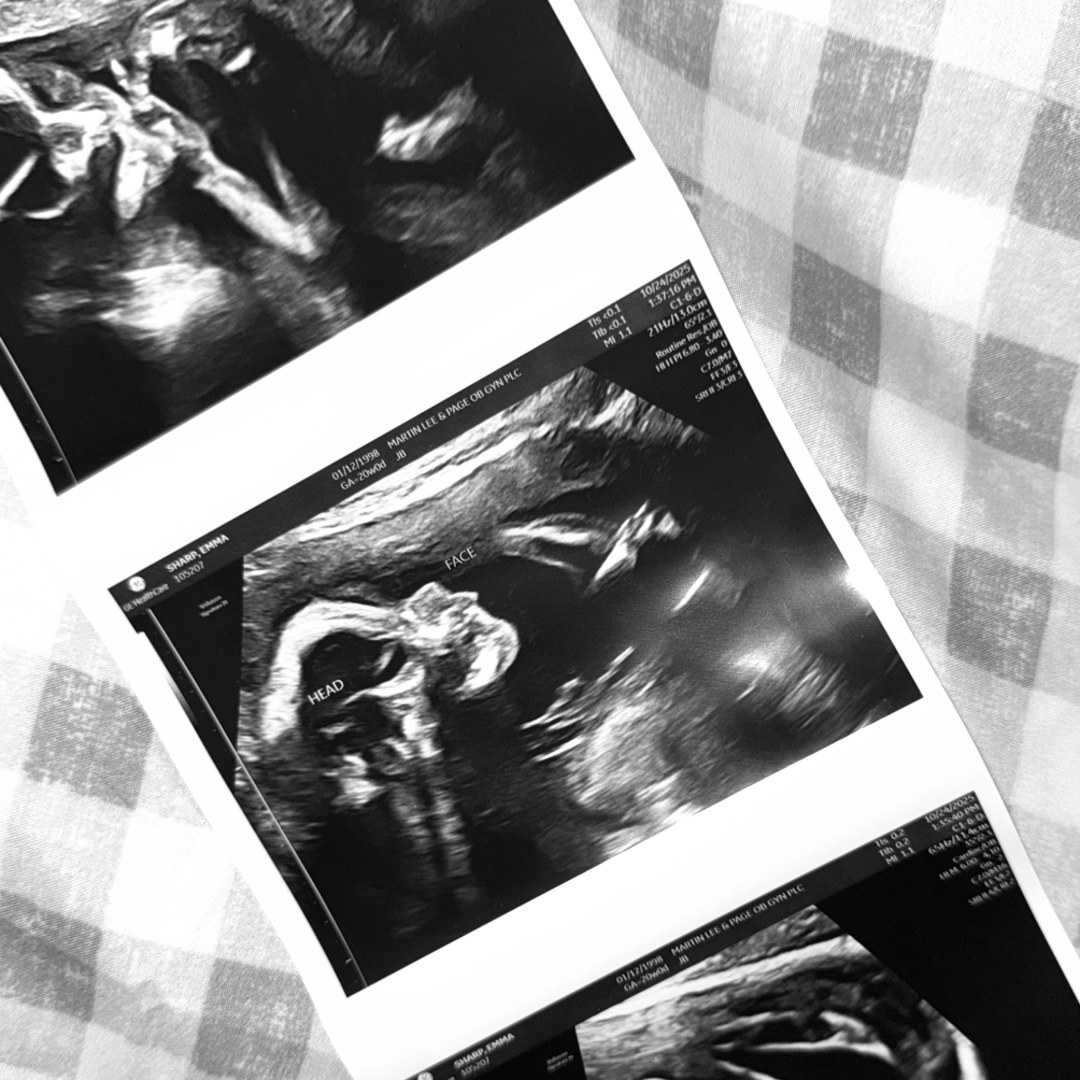 Photo shared by Emma for their Babylist baby registry.