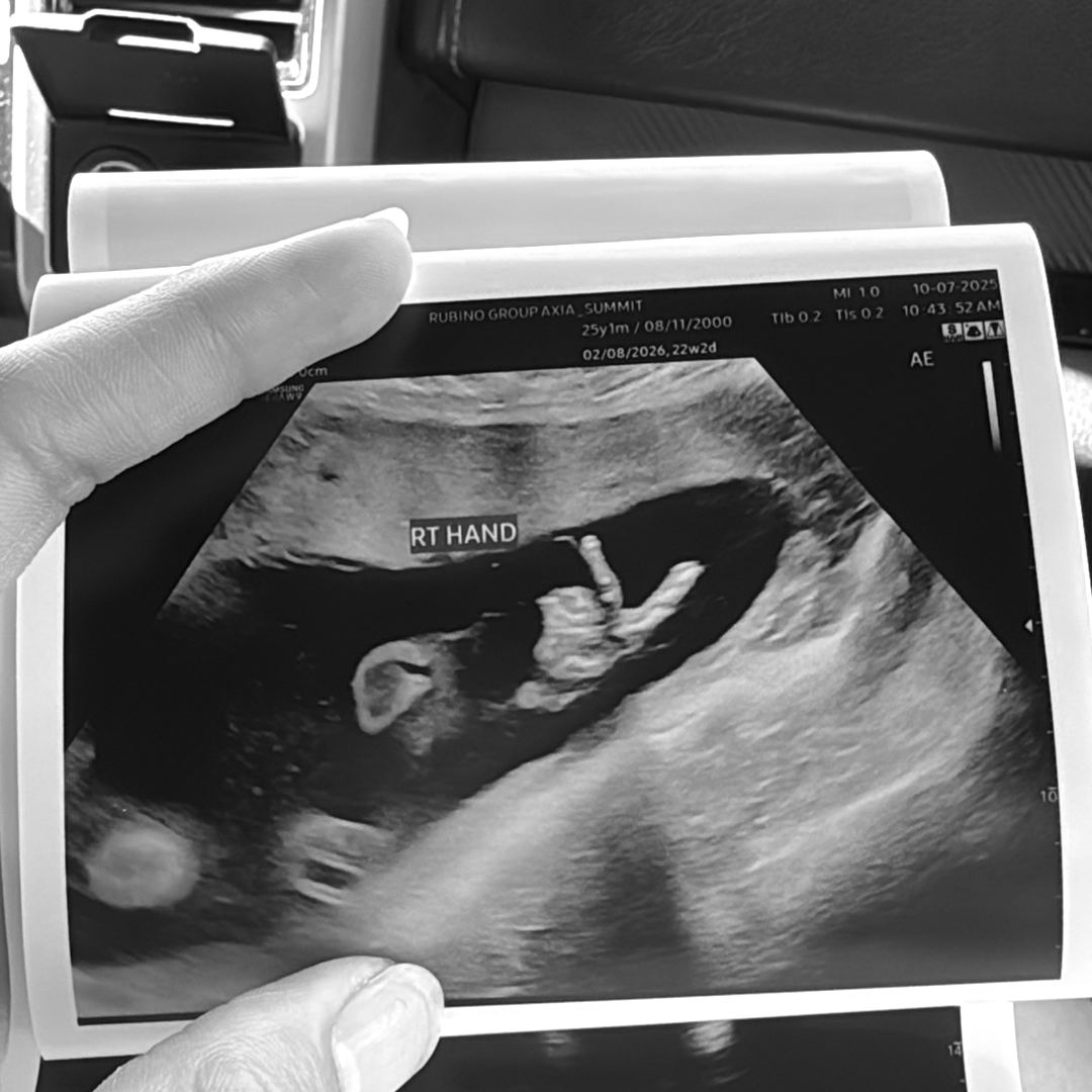 Photo shared by Angy for their Babylist baby registry.