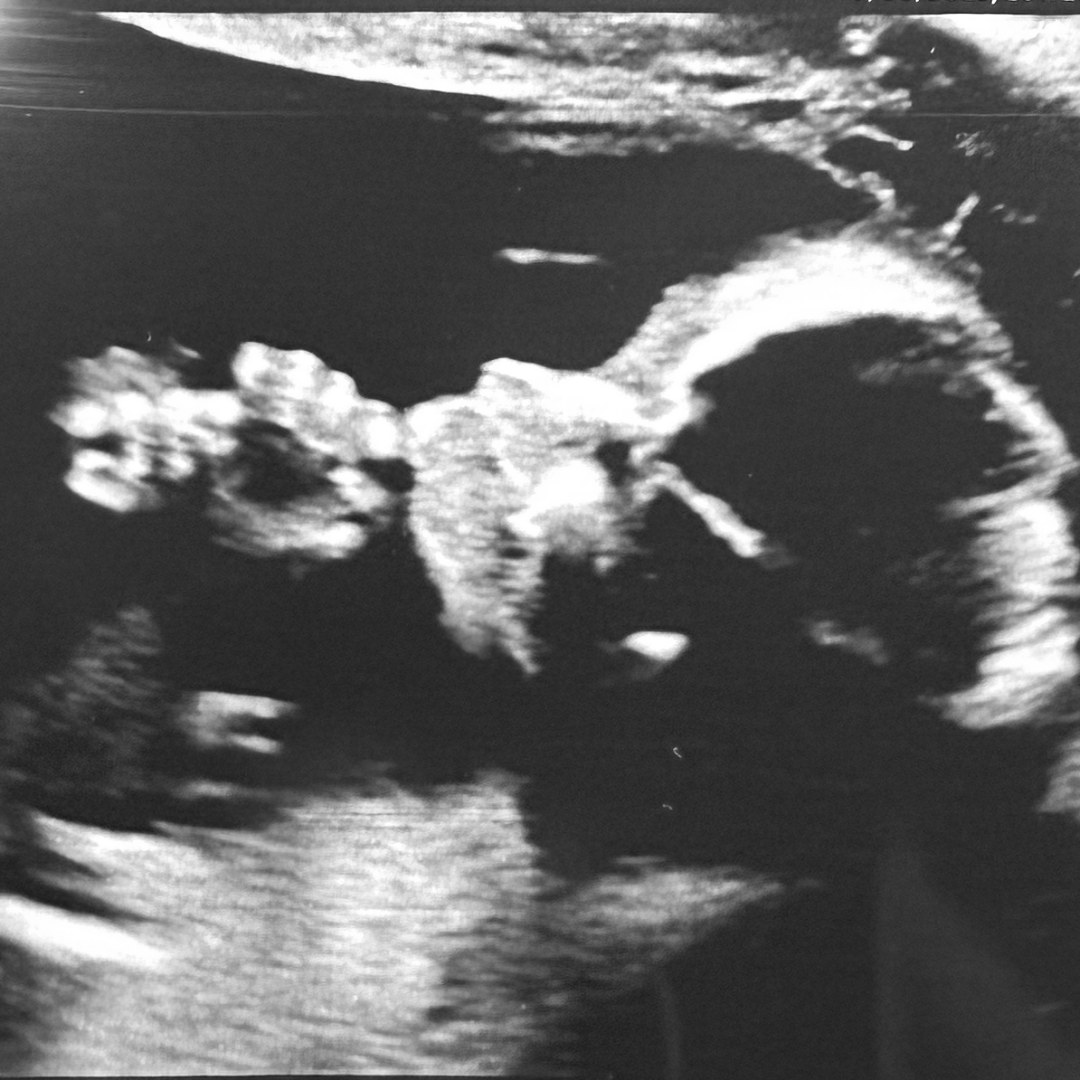 Photo shared by Gabby for their Babylist baby registry.