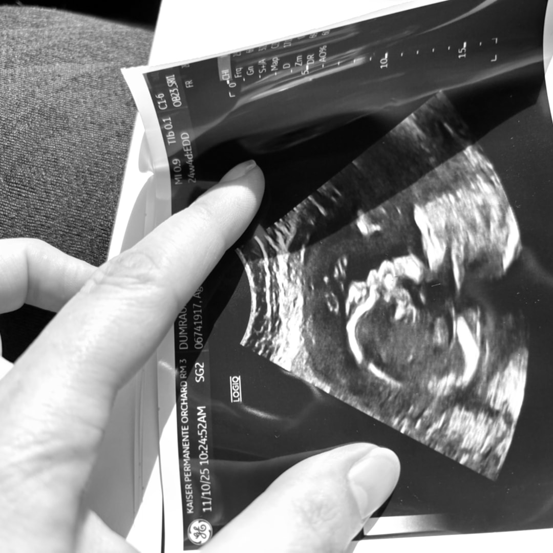 Photo shared by Rochelle for their Babylist baby registry.