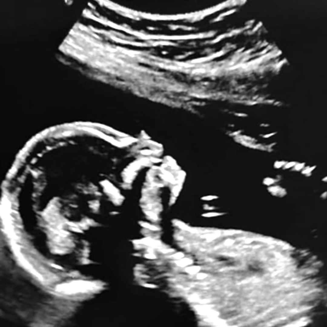 Photo shared by Hannah for their Babylist baby registry.