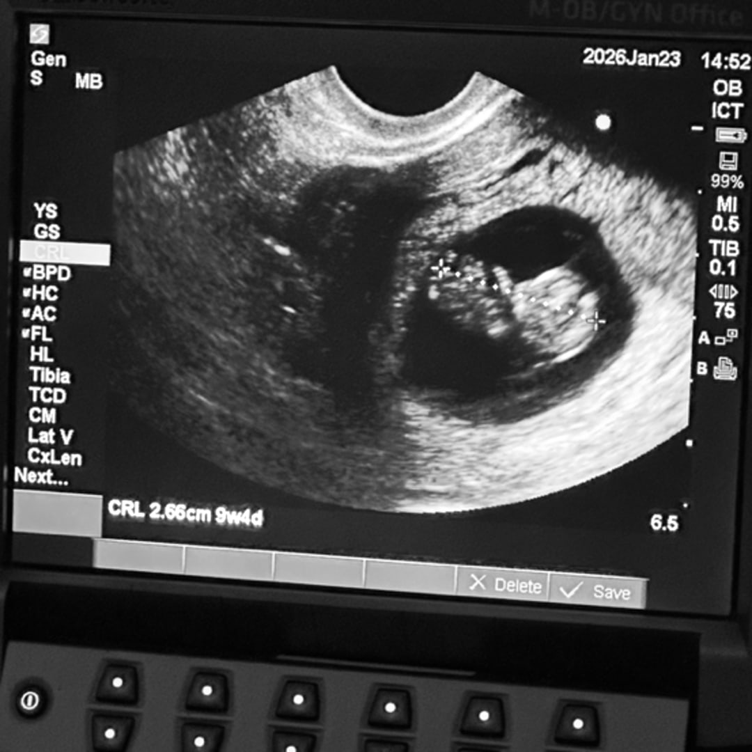 Photo shared by Jacquelin for their Babylist baby registry.