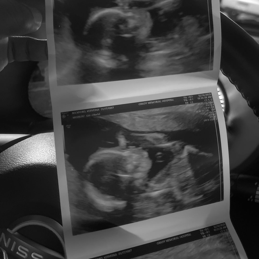 Photo shared by Kerveina for their Babylist baby registry.