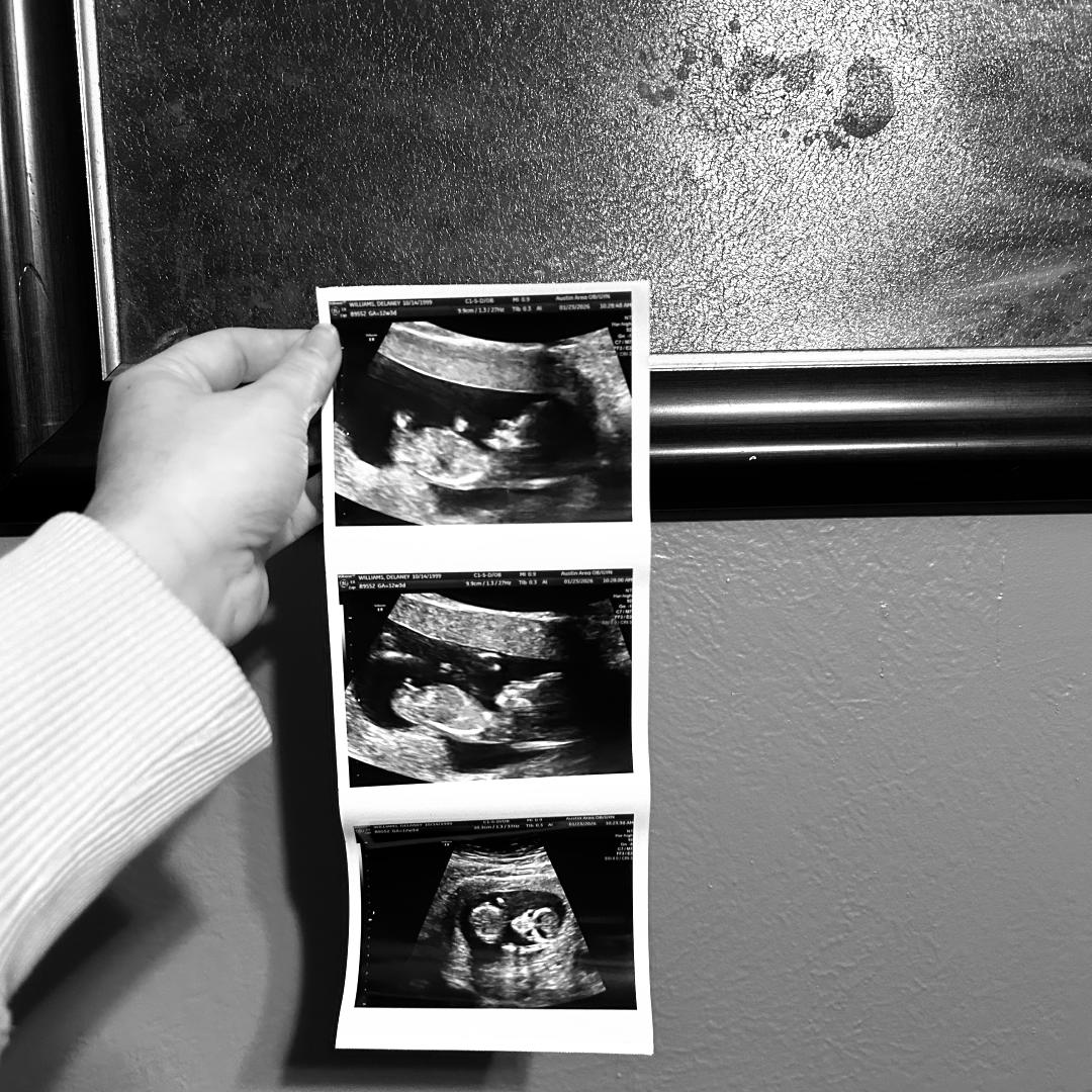 Photo shared by Delaney for their Babylist baby registry.