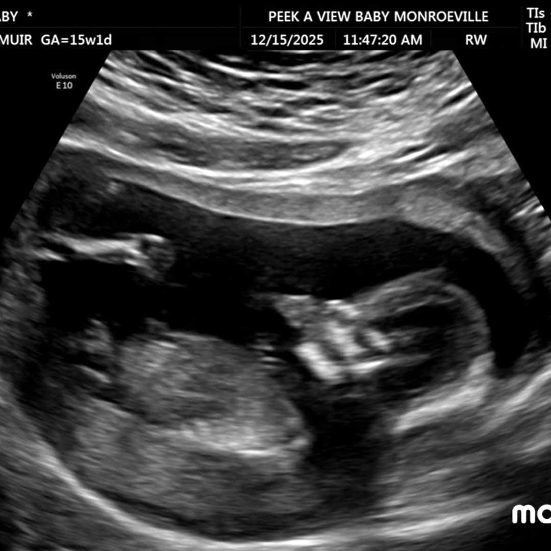 Photo shared by Lindsey for their Babylist baby registry.