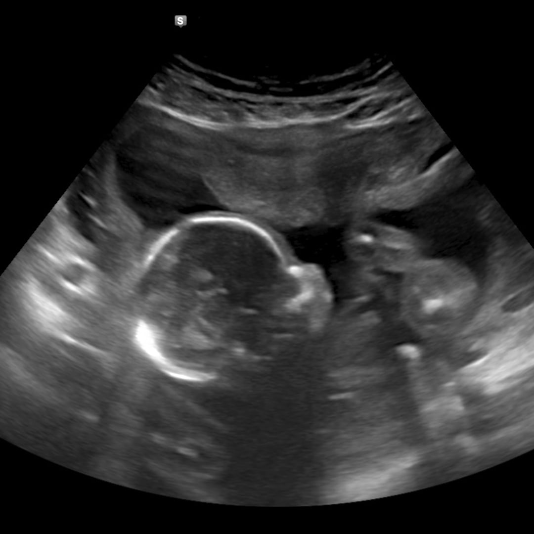 Photo shared by Brooke for their Babylist baby registry.