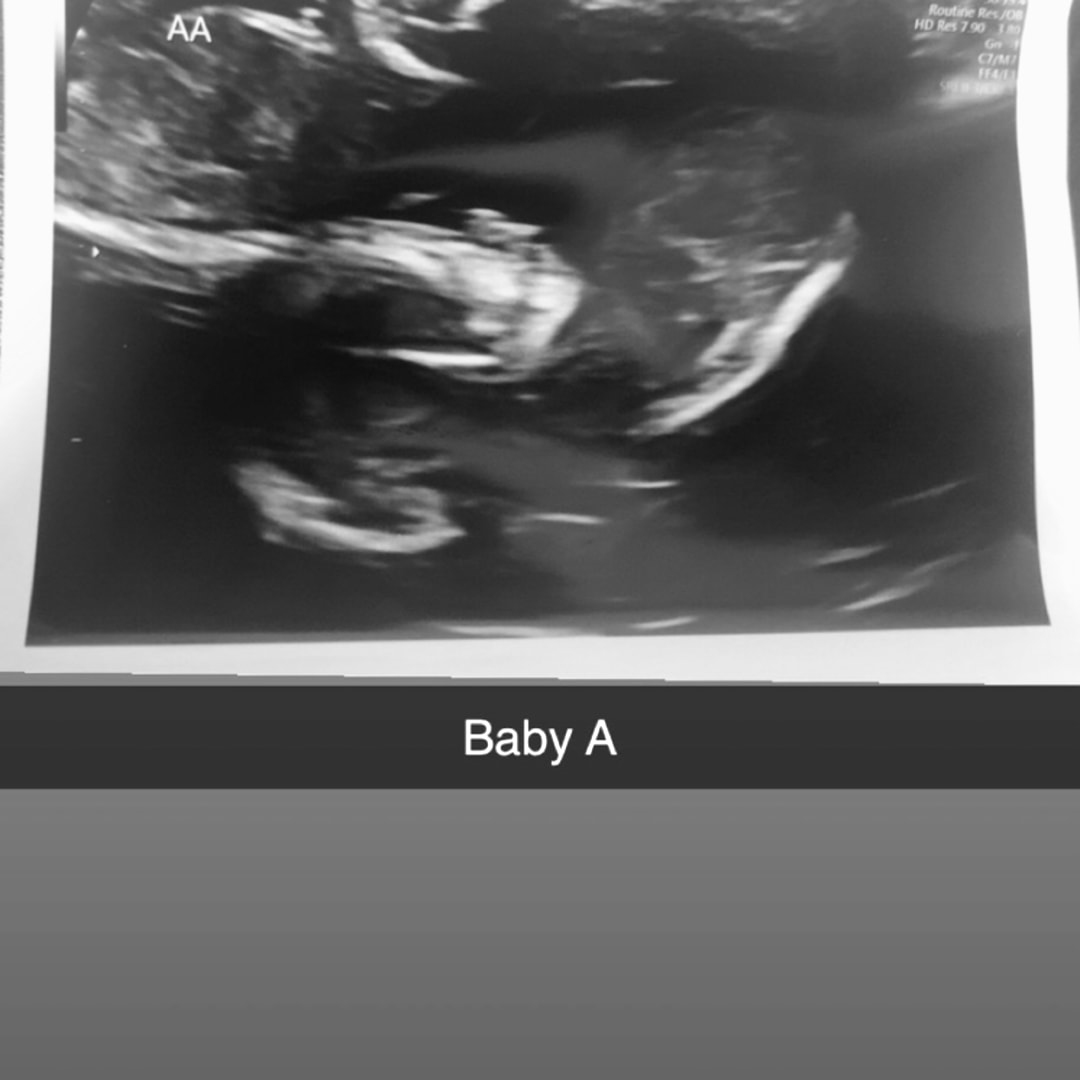 Photo shared by Tahlia for their Babylist baby registry.
