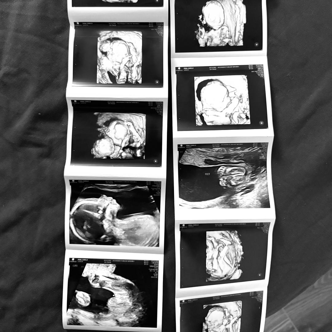 Photo shared by Camille for their Babylist baby registry.