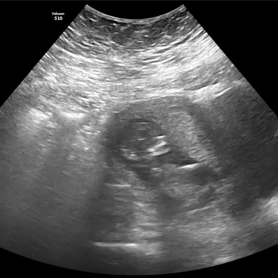 Photo shared by Alison for their Babylist baby registry.