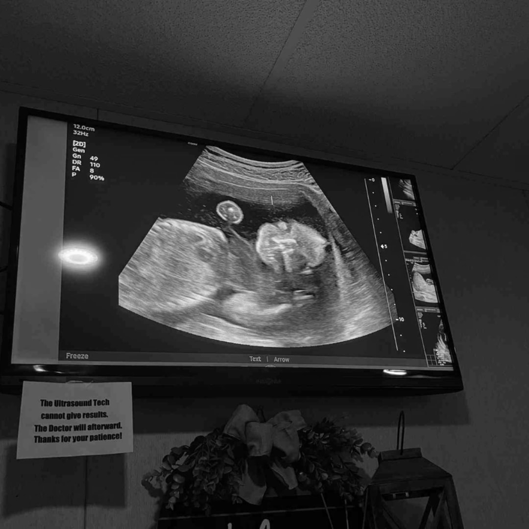 Photo shared by Alli for their Babylist baby registry.