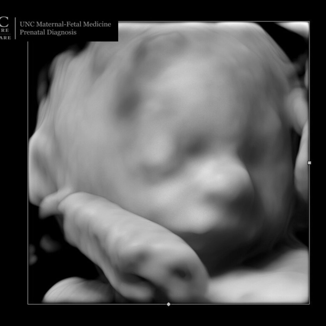 Photo shared by Anna for their Babylist baby registry.