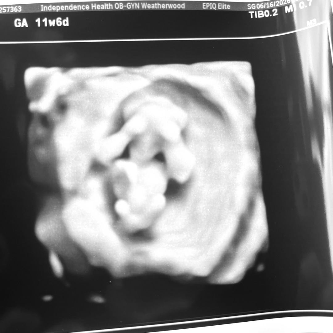 Photo shared by Elizabeth for their Babylist baby registry.
