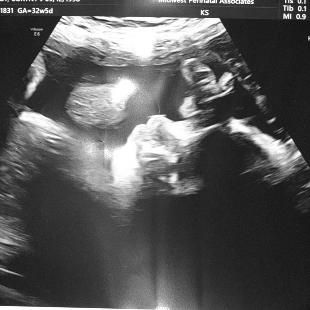 Photo shared by Cortny for their Babylist baby registry.