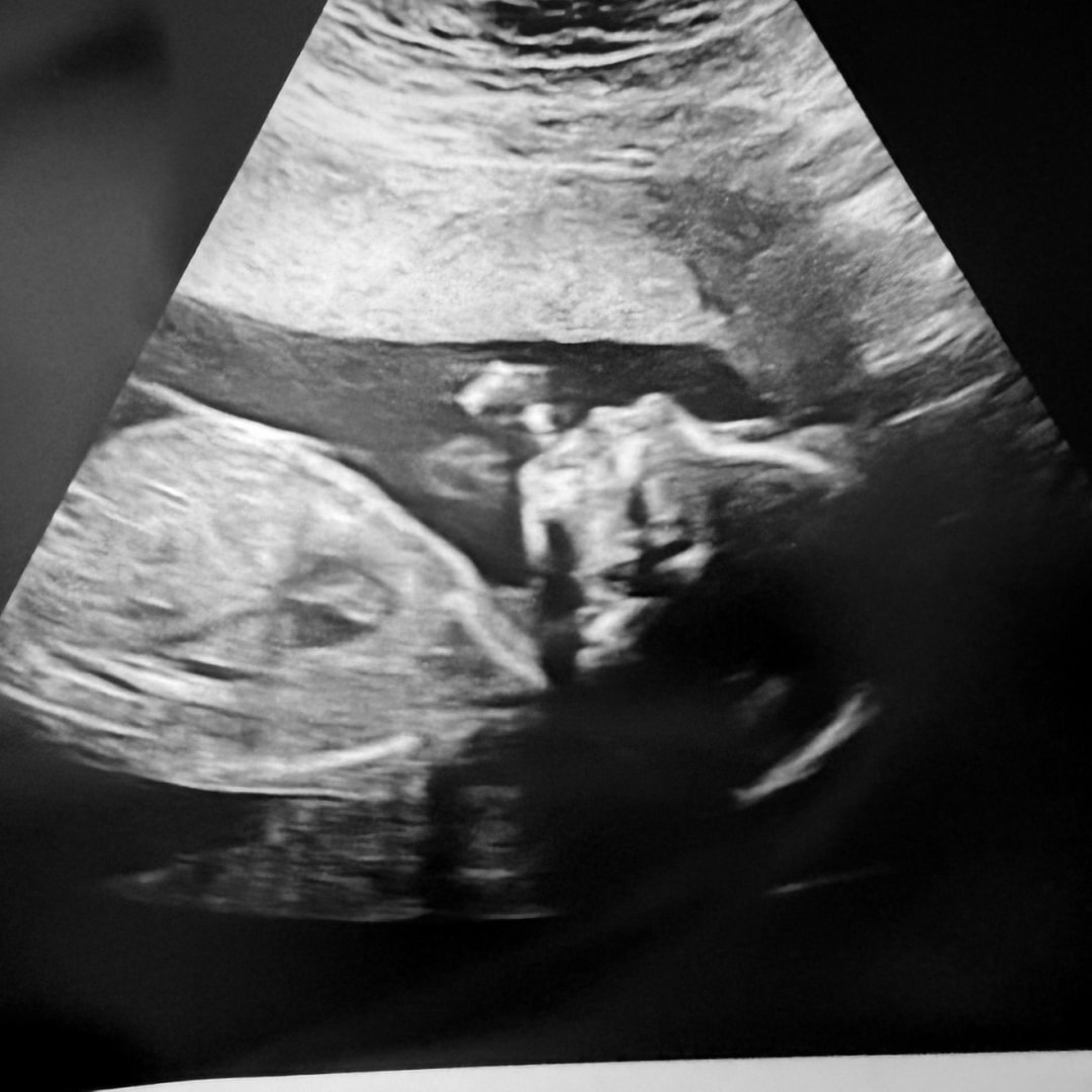 Photo shared by Candy for their Babylist baby registry.