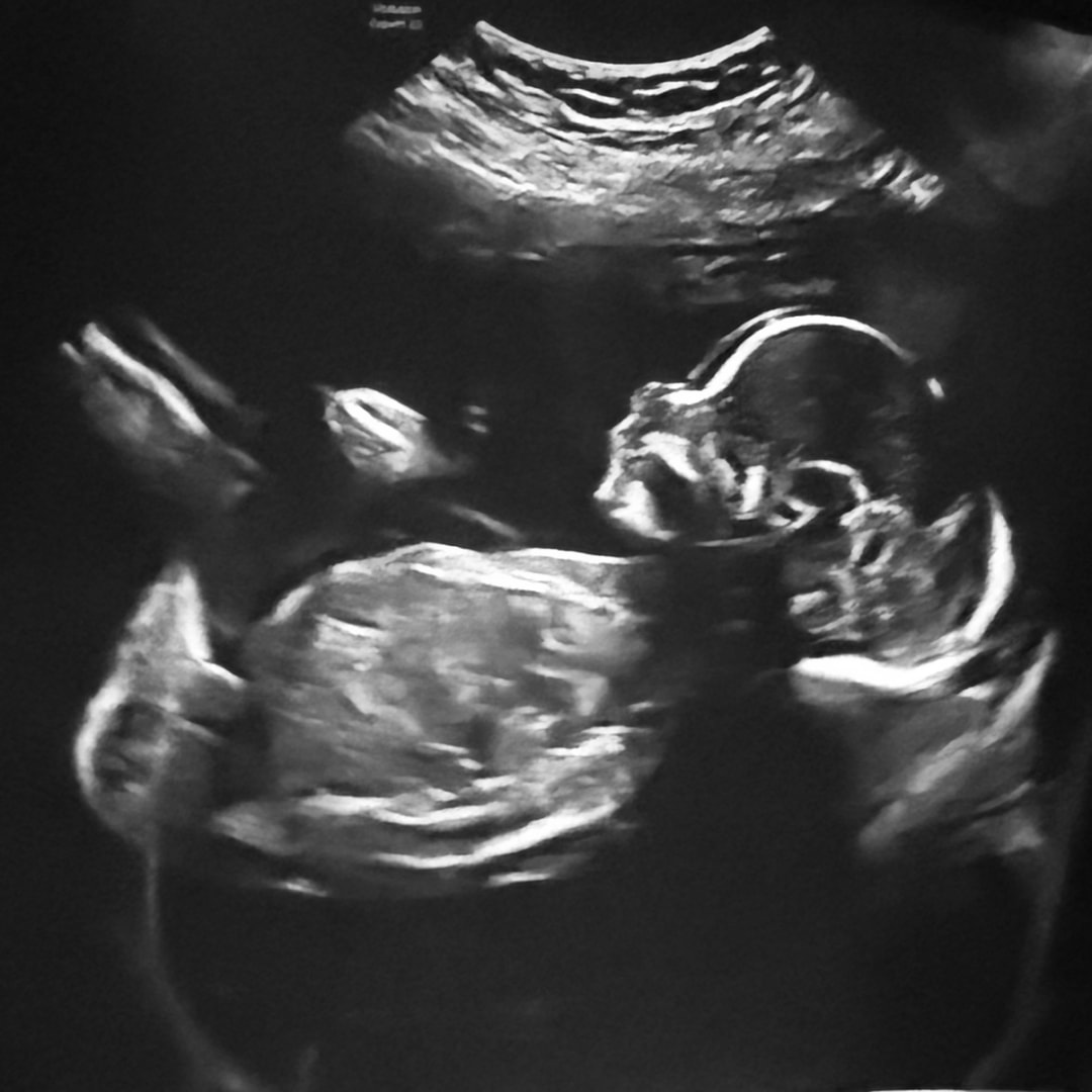 Photo shared by Elizabeth for their Babylist baby registry.