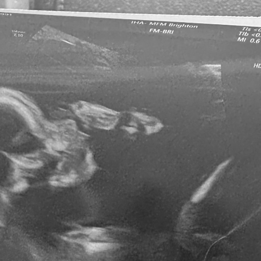 Photo shared by Caili for their Babylist baby registry.