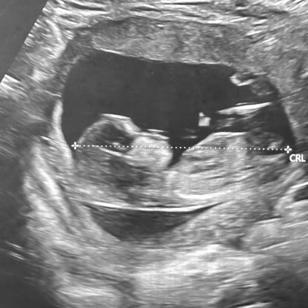 Photo shared by Helena for their Babylist baby registry.