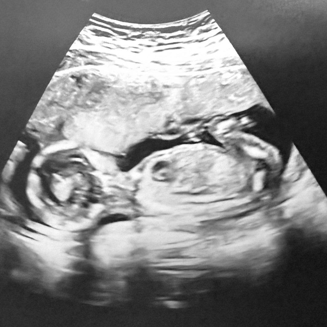 Photo shared by Aundreah for their Babylist baby registry.