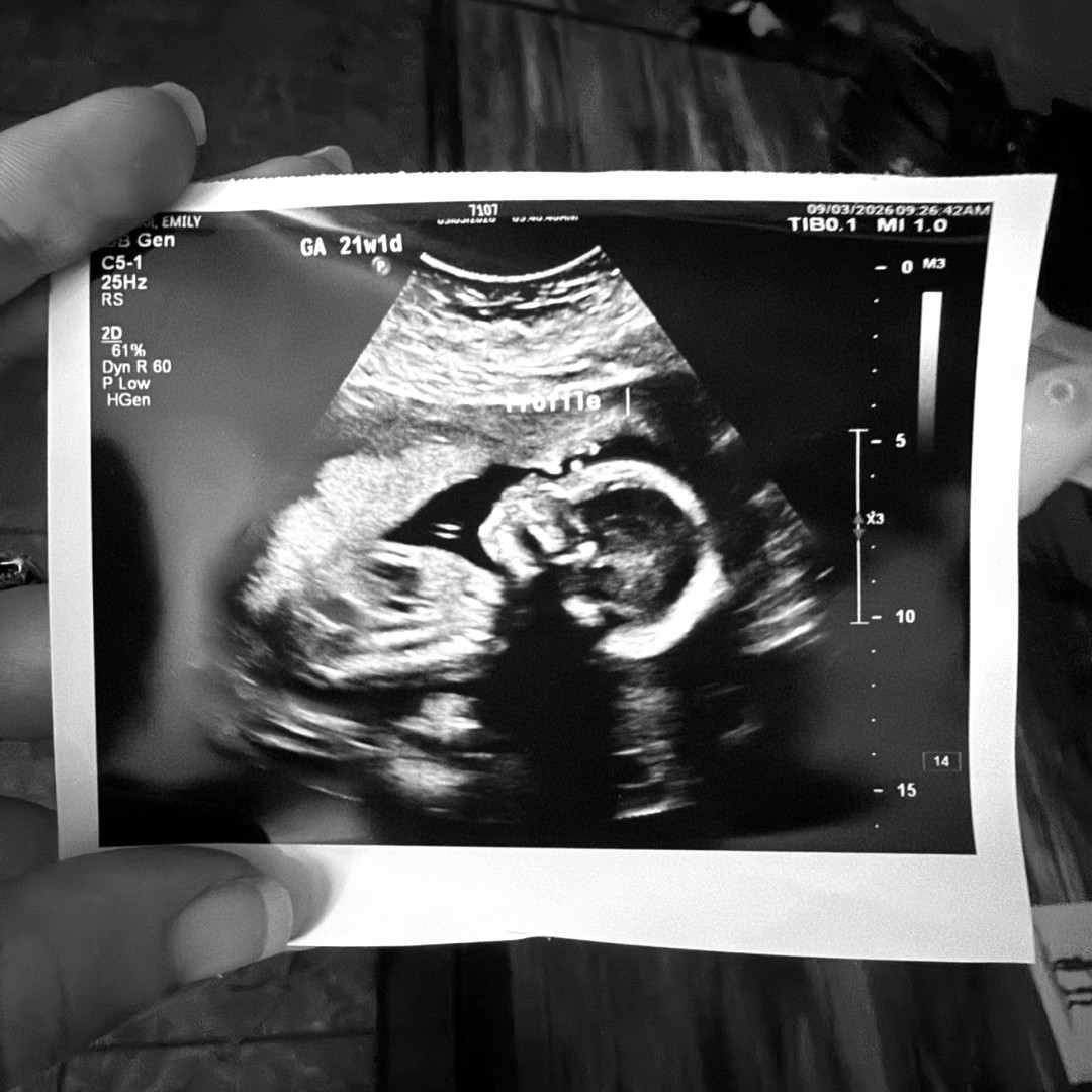 Photo shared by Emily for their Babylist baby registry.