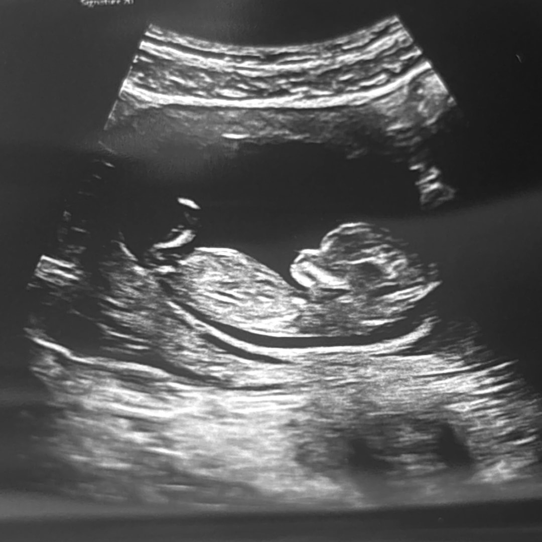 Photo shared by Ella for their Babylist baby registry.