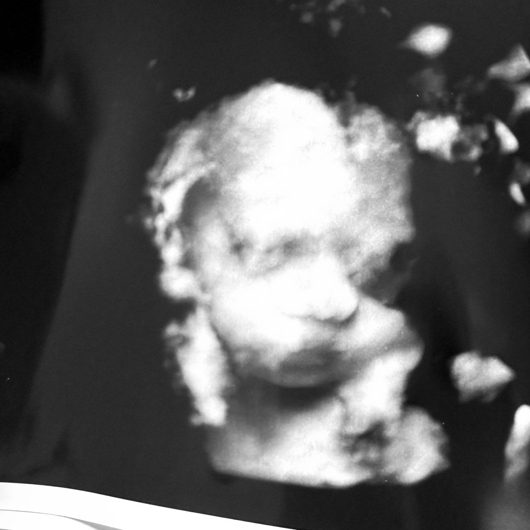 Photo shared by Kenzie for their Babylist baby registry.