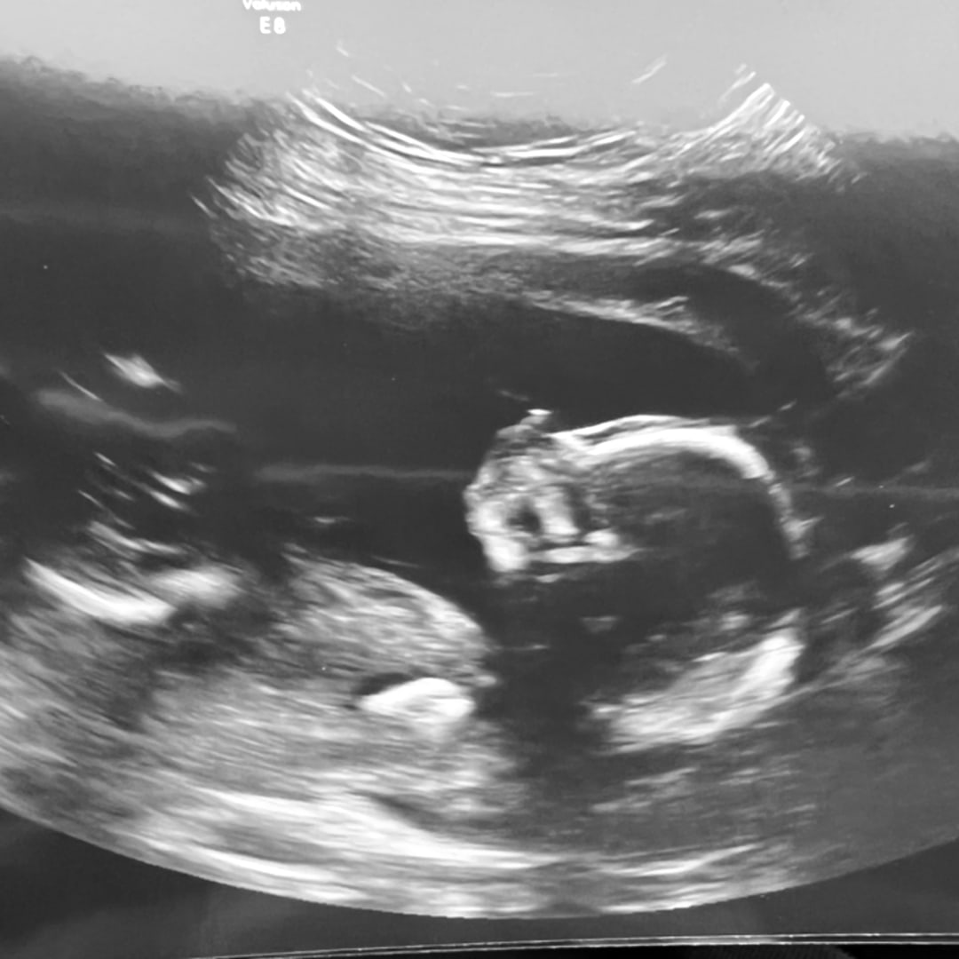 Photo shared by Jessica for their Babylist baby registry.