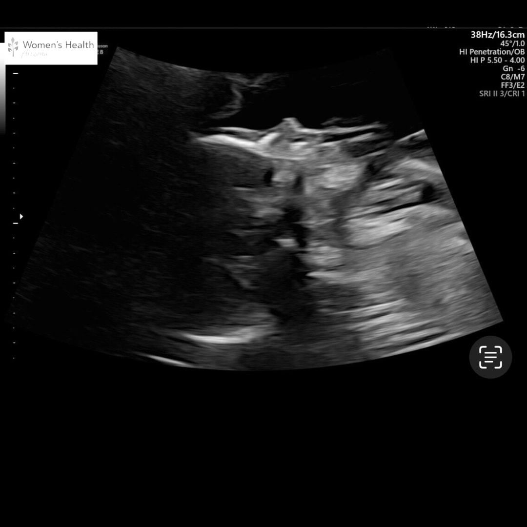 Photo shared by Zeruiah & jose for their Babylist baby registry.