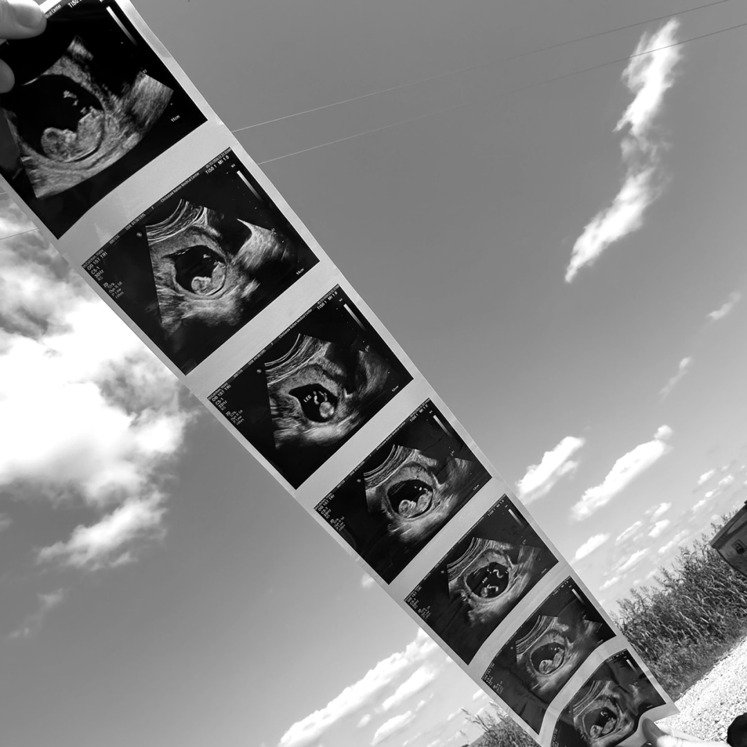 Photo shared by Haley for their Babylist baby registry.
