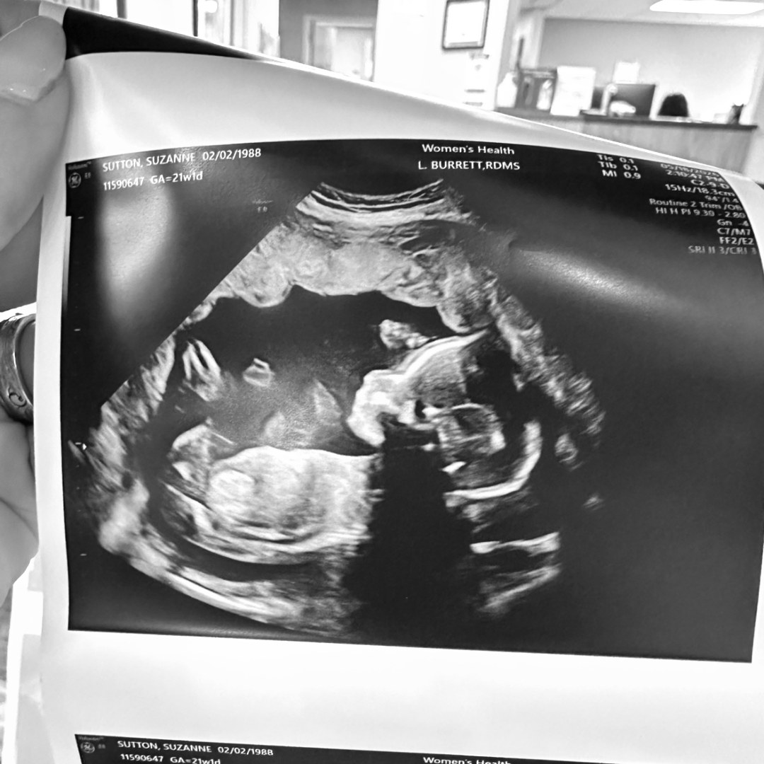 Photo shared by Suzanna for their Babylist baby registry.